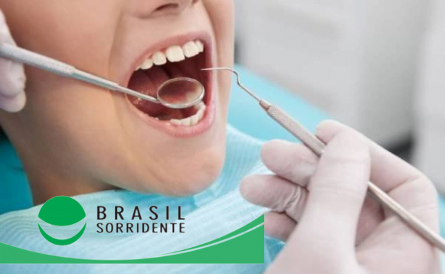Projeto Brasil Sorridente 2022 Como Participar E Ter Atendimento Odontológico Gratuito Pelo Sus 3817